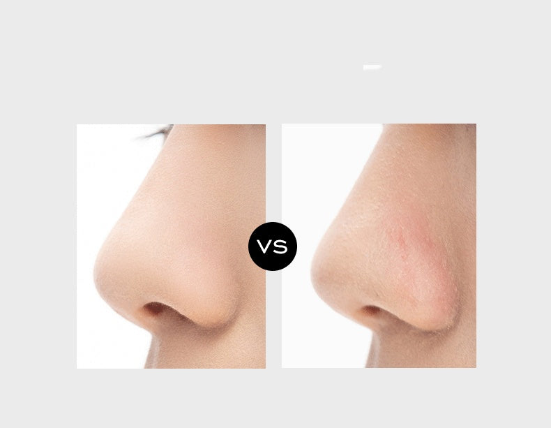 Vacuum blackhead instrument electric suction pore