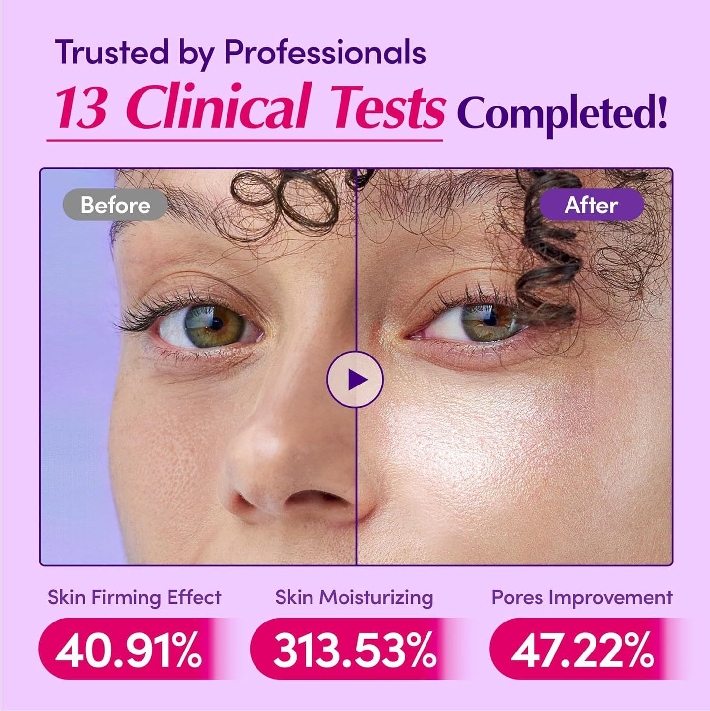 Fructus Psoraleae Phenol Fengying Essence Moisturizing And Softening Skin