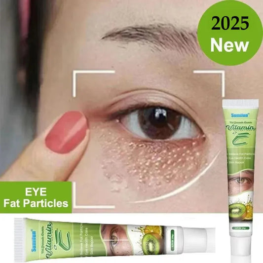 Milia Remover Eye Cream – Puffiness & Fat Granule Repair